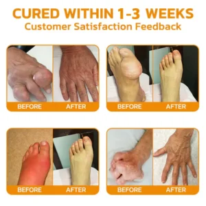 Lidocaine Arthritis Pain Relief Healing Gel - Image 2
