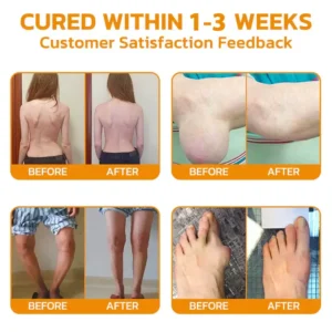 Lidocaine Arthritis Pain Relief Healing Gel - Image 3