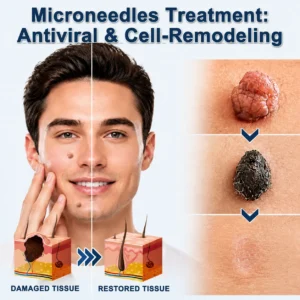 2-in-1 Microneedle & Hydrocolloid Patch - Image 5