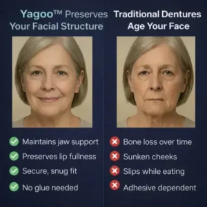 Newly upgraded second-generation complete dentures - Image 7