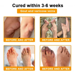 Bee Venom Pain-Relief Bone Healing Cream - Image 2