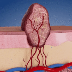 2-in-1 Microneedle & Hydrocolloid Patch - Image 6