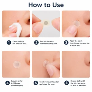 2-in-1 Microneedle & Hydrocolloid Patch - Image 15