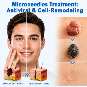 2-in-1 Microneedle & Hydrocolloid Patch - Image 5