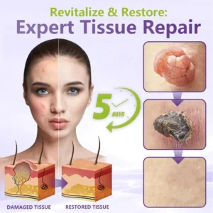 SOLUBLE MICRONEEDLE BOTANICAL SKIN TAG REMOVAL PATCH - Image 2