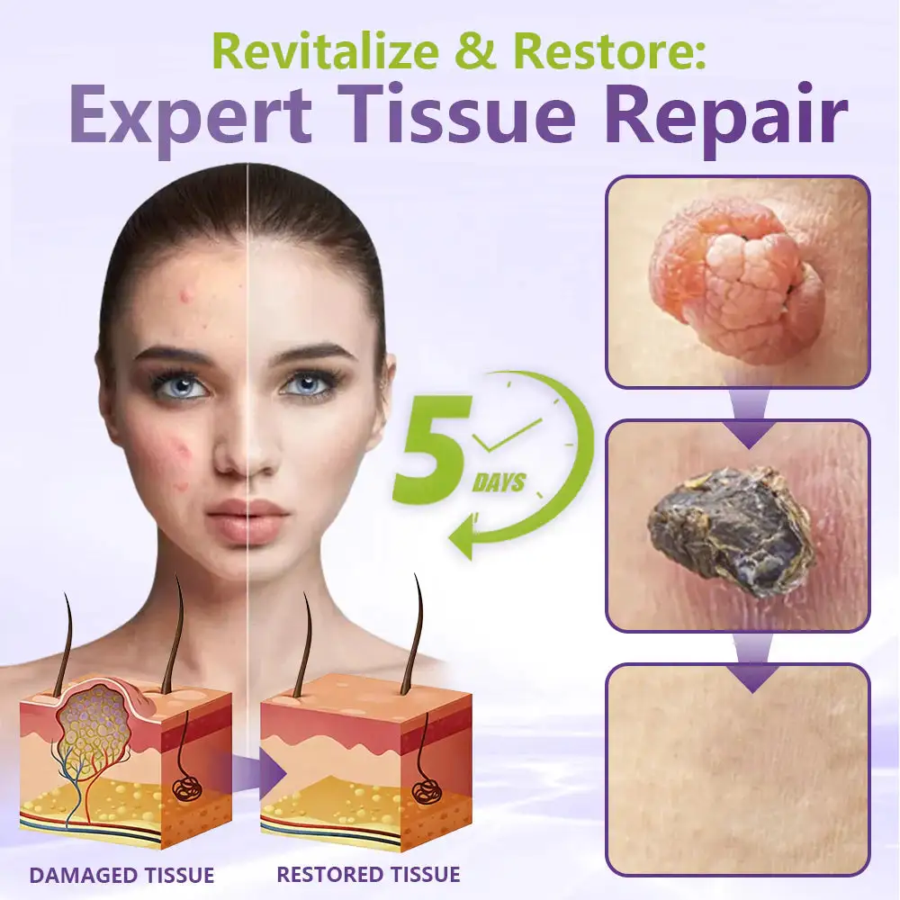 SOLUBLE MICRONEEDLE BOTANICAL SKIN TAG REMOVAL PATCH - Image 2