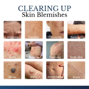 DermFixPro 2-in-1 Microneedle & Hydrocolloid Patch - Image 3