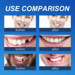 Natural Smile Upgrade - Image 9