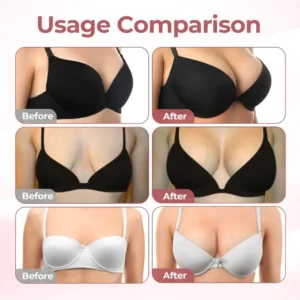 BREAST ENHANCEMENT LIFT & FIRM MICRONEEDLE PATCHES - Image 3