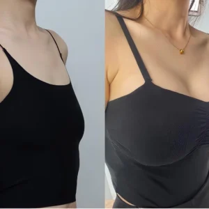 BREAST ENHANCEMENT LIFT & FIRM MICRONEEDLE PATCHES - Image 5