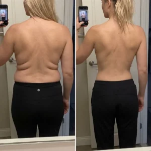 BREAST ENHANCEMENT LIFT & FIRM MICRONEEDLE PATCHES - Image 8