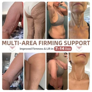BREAST ENHANCEMENT LIFT & FIRM MICRONEEDLE PATCHES - Image 9