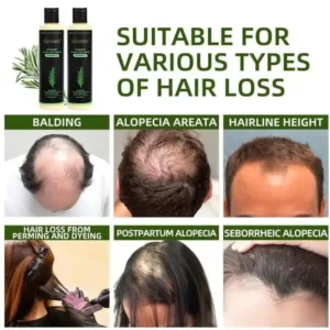 Organic Rosemary Hair Growth Shampoo - Image 5