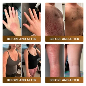 Botox & Bee Venom Advanced Recovery Cream - Image 6