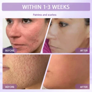 Anti-aging & Spot-repair Serum - Image 10
