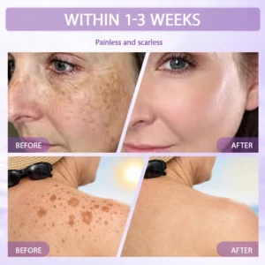 Anti-aging & Spot-repair Serum - Image 12