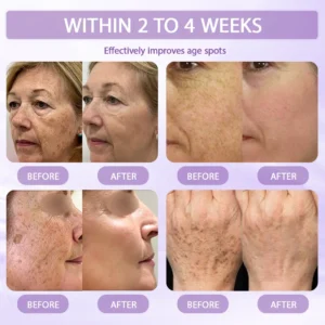 Anti-aging & Spot-repair Serum - Image 4