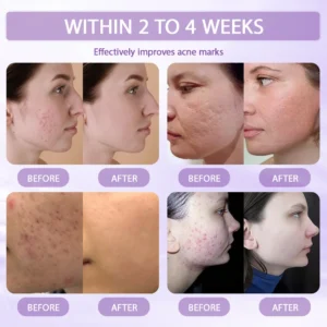 Anti-aging & Spot-repair Serum - Image 5