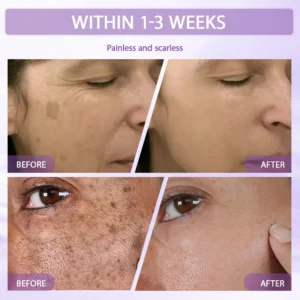 Anti-aging & Spot-repair Serum - Image 9