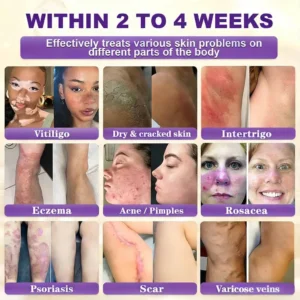 Biotin 10-in-1 Skin Repair Cream — Last Day of Sale: 75% Off - Image 2