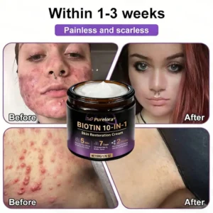 Biotin 10-in-1 Skin Repair Cream — Last Day of Sale: 75% Off - Image 6