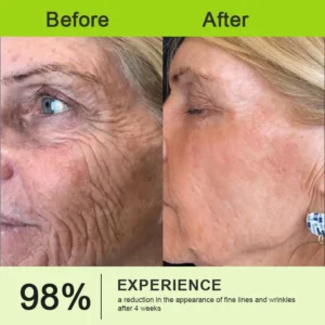 Botox & Vita-A Retinol Shot Wrinkle-Lift Tightening stick - Image 13