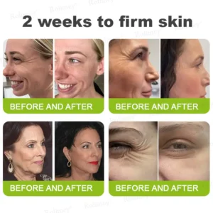 Botox & Vita-A Retinol Shot Wrinkle-Lift Tightening cream - Image 5
