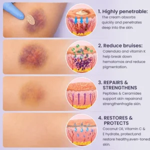 Bruise Recovery Cream - Image 12