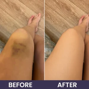 Bruise Recovery Cream - Image 14
