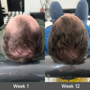 2-in-1 Onion & Rosemary Shampoo + Conditioner - Image 7