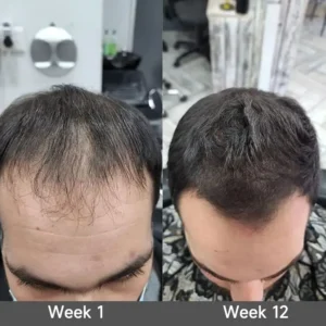 2-in-1 Onion & Rosemary Shampoo + Conditioner - Image 8