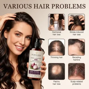 Onion & Rosemary 2-in-1 Shampoo & Conditioner with 15X Active Complex for Hair Growth - Image 12