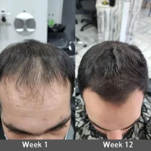Onion & Rosemary 2-in-1 Shampoo & Conditioner with 15X Active Complex for Hair Growth - Image 8