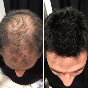 Onion & Rosemary 2-in-1 Shampoo & Conditioner with 15X Active Complex for Hair Growth - Image 9