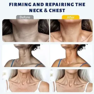 5-Roller Neck Firming Cream - Image 3