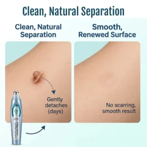 SpotlessPro Advanced Skin Care Pen - Image 9