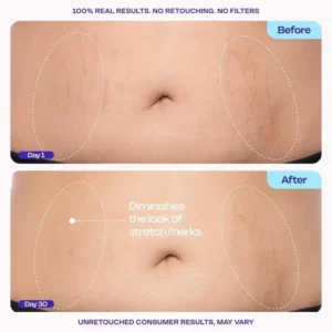 QIAWI TIGHTEN & SMOOTH BELLY FIRMING CREAM - Image 9