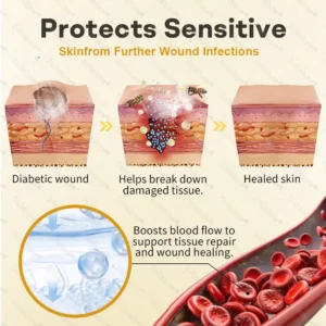 Bee Venom Intensive Diabetic Foot Treatment Spray - Image 5