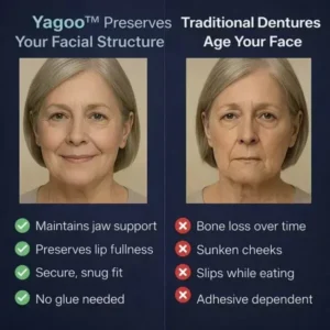 PREMIUM FULL DENTURE SET - Image 3