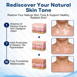 Advanced Piperine Vitiligo Repigmentation Spray - Image 2