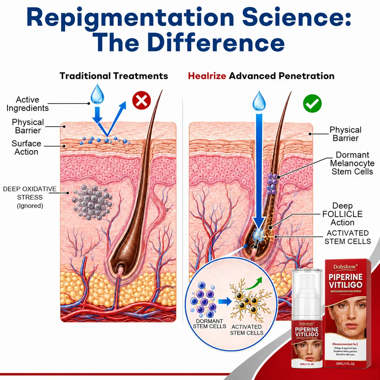 Advanced Piperine Vitiligo Repigmentation Spray - Image 6