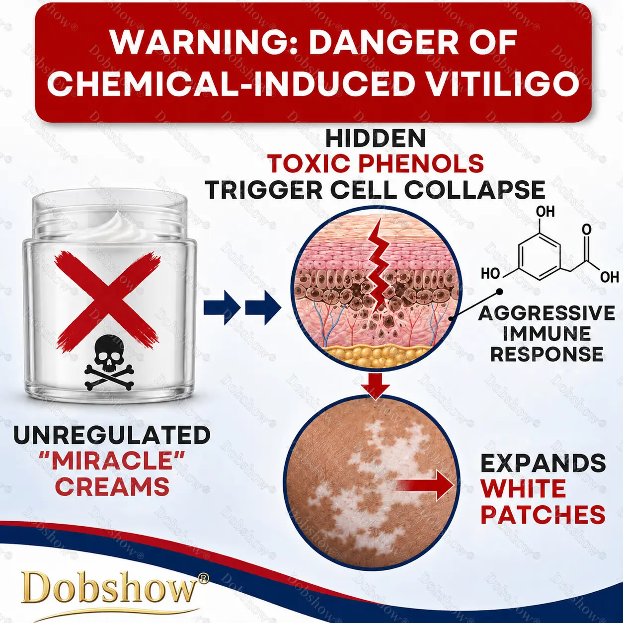 Advanced Piperine Vitiligo Repigmentation Spray - Image 8