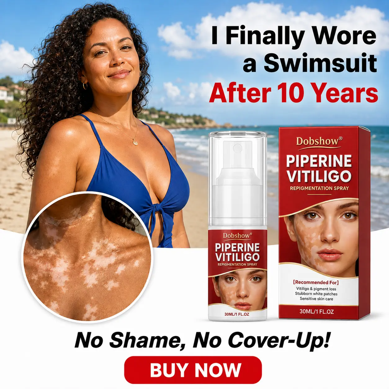 Advanced Piperine Vitiligo Repigmentation Spray - Image 9