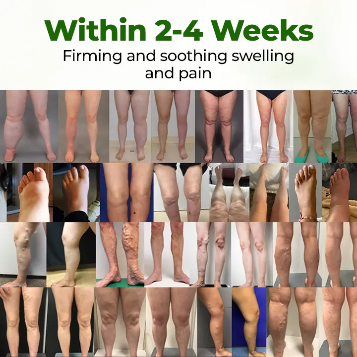 Professional Leg Circulation Cream - Image 3