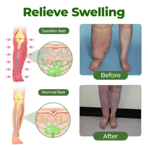 Professional Leg Circulation Cream - Image 5