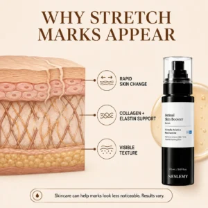 NESLEMY Advanced Retinal Stretch Mark Serum - Image 10