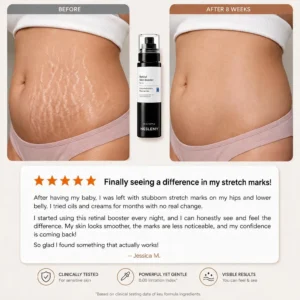 NESLEMY Advanced Retinal Stretch Mark Serum - Image 5