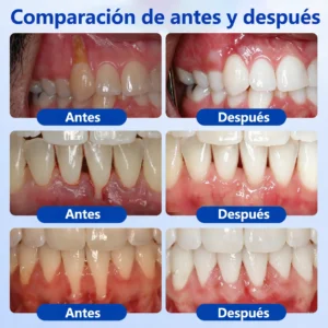 𝑮𝒖𝒎𝑹𝒆𝒗𝒊𝒗𝒆 𝑮𝒆𝒍 𝑹𝒆𝒑𝒂𝒓𝒂𝒅𝒐𝒓 𝑷𝒆𝒓𝒊𝒐𝒅𝒐𝒏𝒕𝒂𝒍 - Image 3