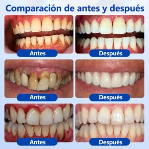 𝑮𝒖𝒎𝑹𝒆𝒗𝒊𝒗𝒆 𝑮𝒆𝒍 𝑹𝒆𝒑𝒂𝒓𝒂𝒅𝒐𝒓 𝑷𝒆𝒓𝒊𝒐𝒅𝒐𝒏𝒕𝒂𝒍 - Image 4