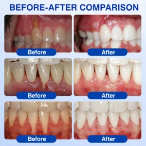 𝑮𝒖𝒎𝑹𝒆𝒗𝒊𝒗𝒆 𝑷𝒆𝒓𝒊𝒐𝒅𝒐𝒏𝒕𝒊𝒂 𝑹𝒂𝒑𝒂𝒊𝒓 𝑮𝒆𝒍 - Image 3
